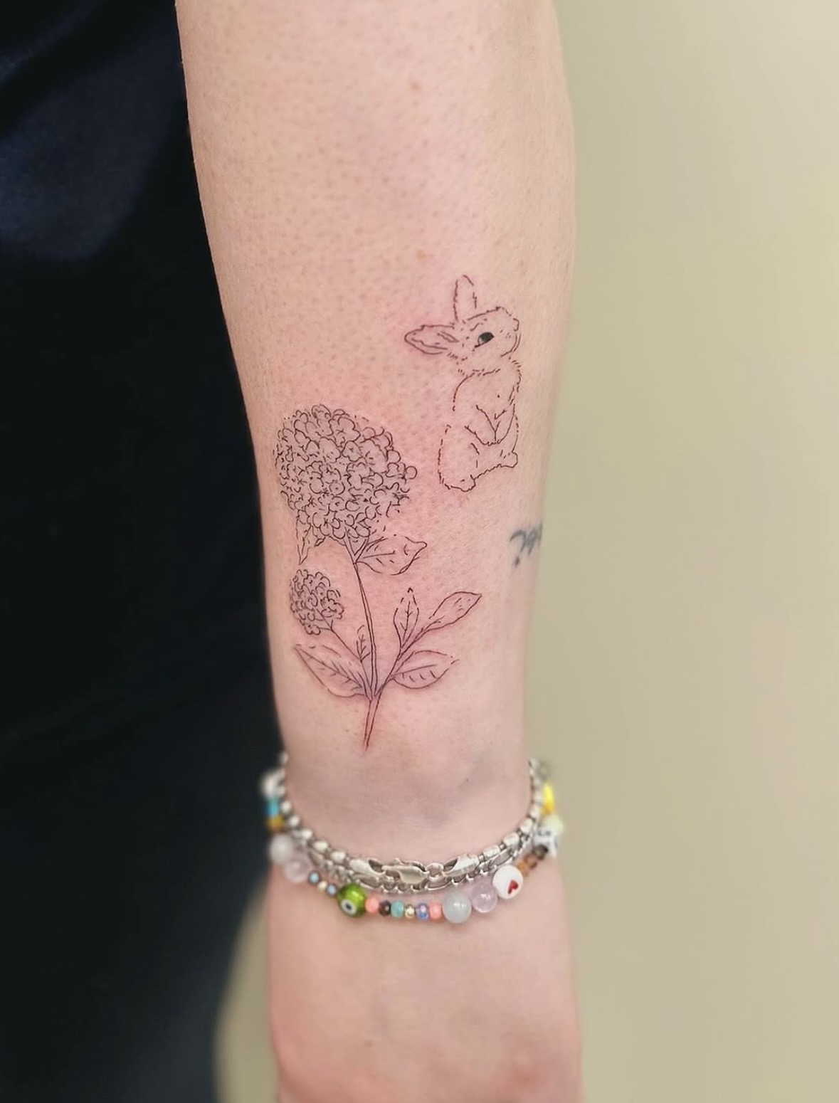 fine-line — forearm