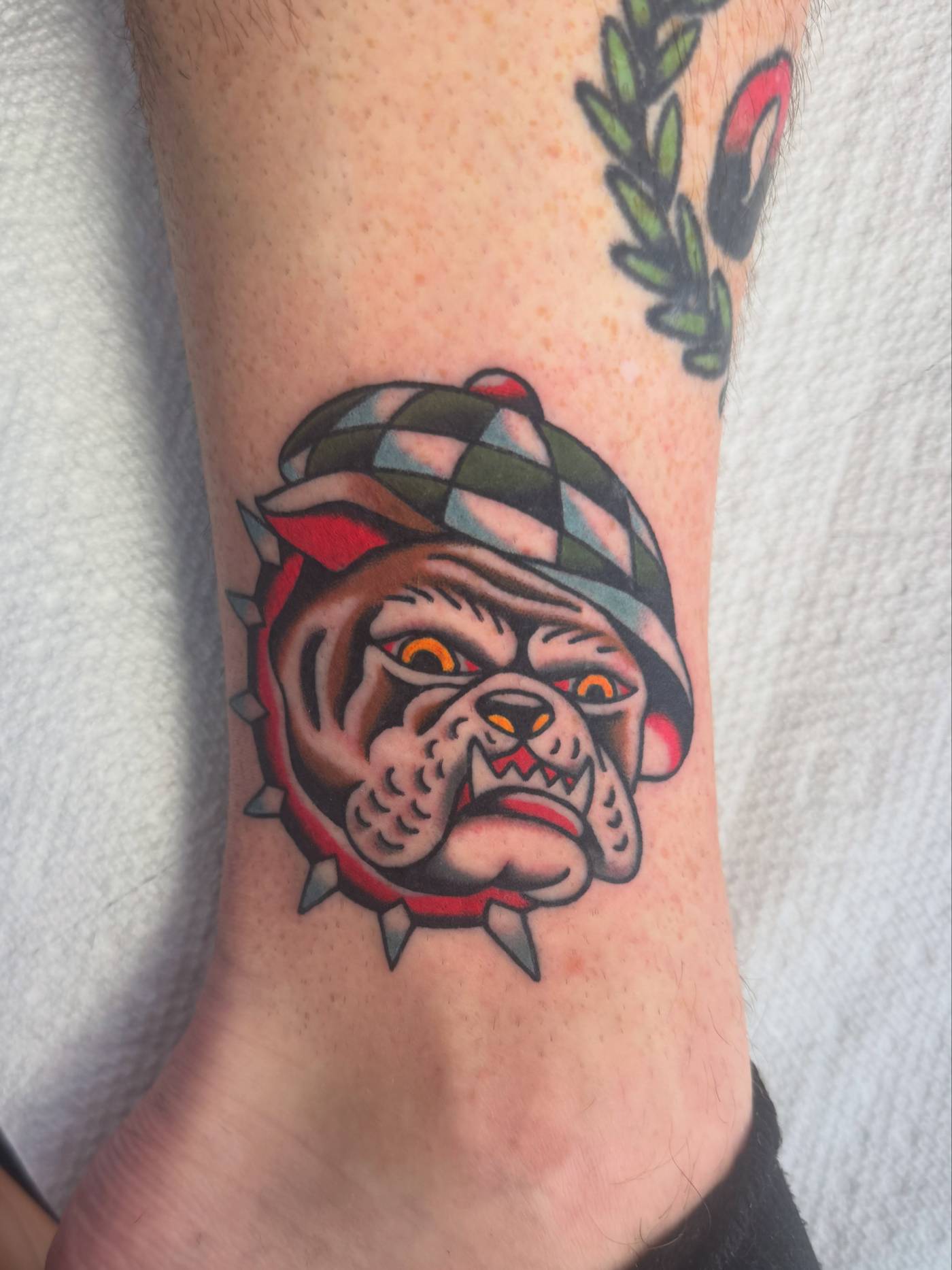 Work by Brice Hamm on ankle