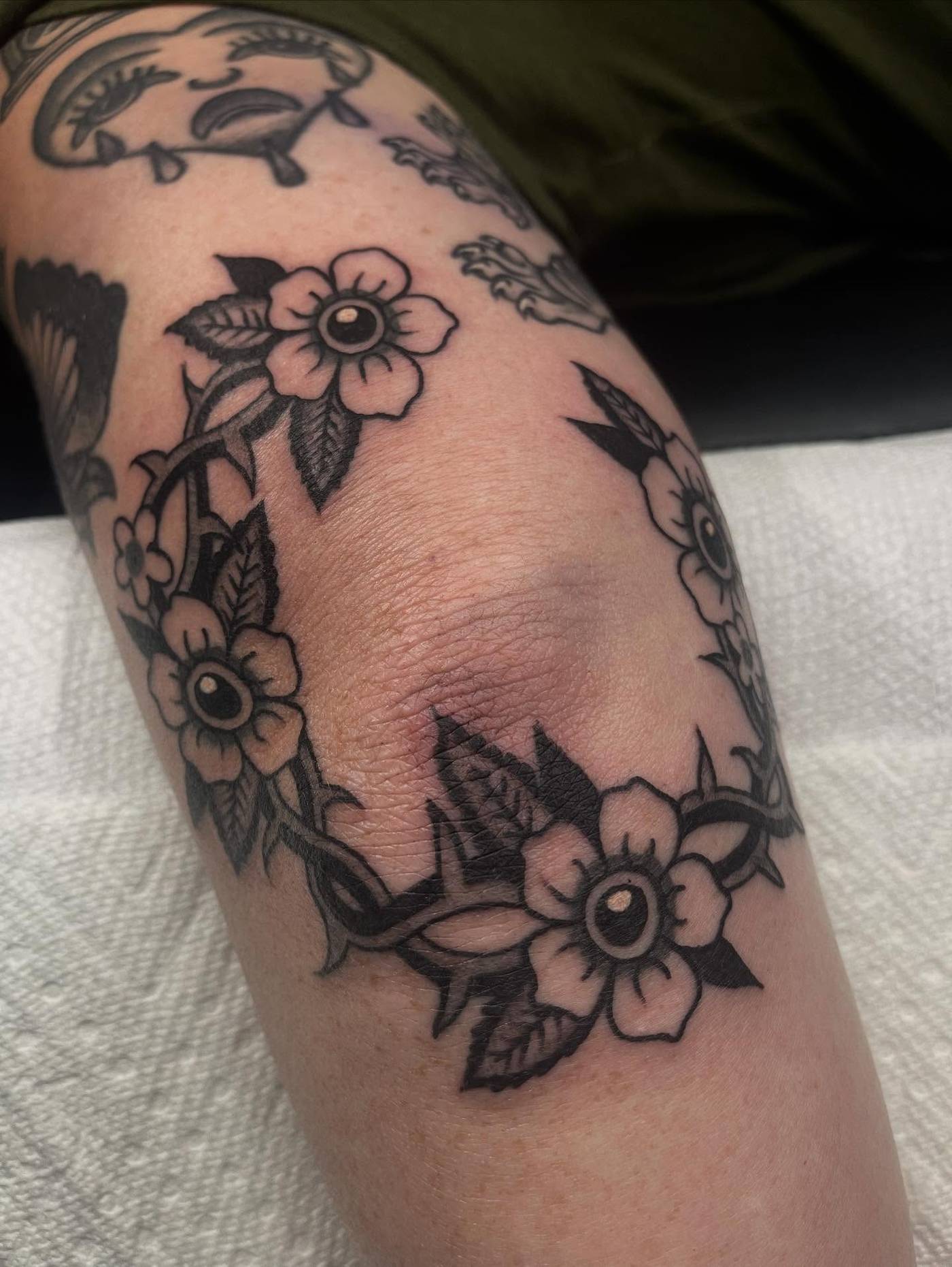 Work by Kyle Mcmeans on knee