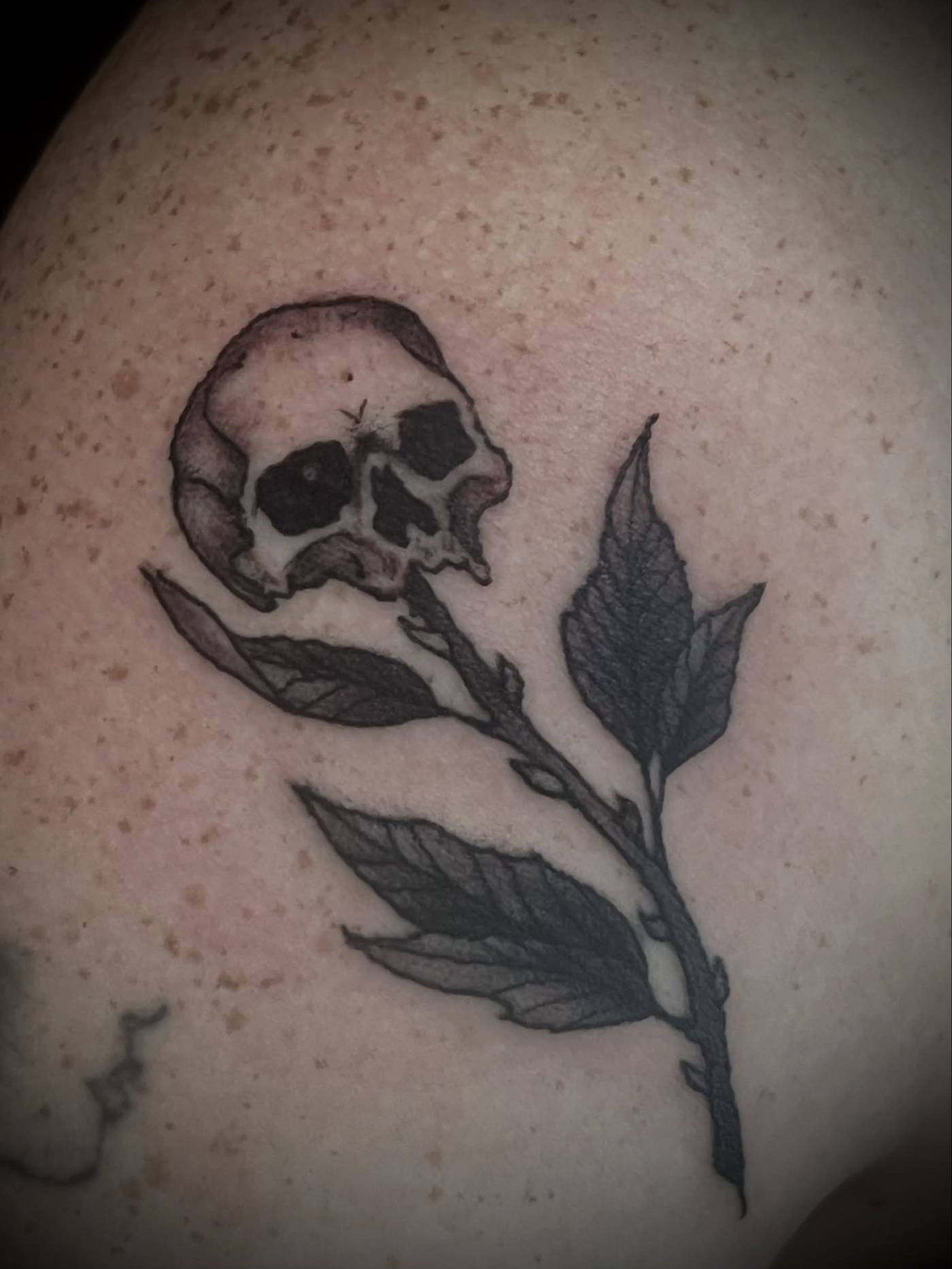 illustrative — shoulder