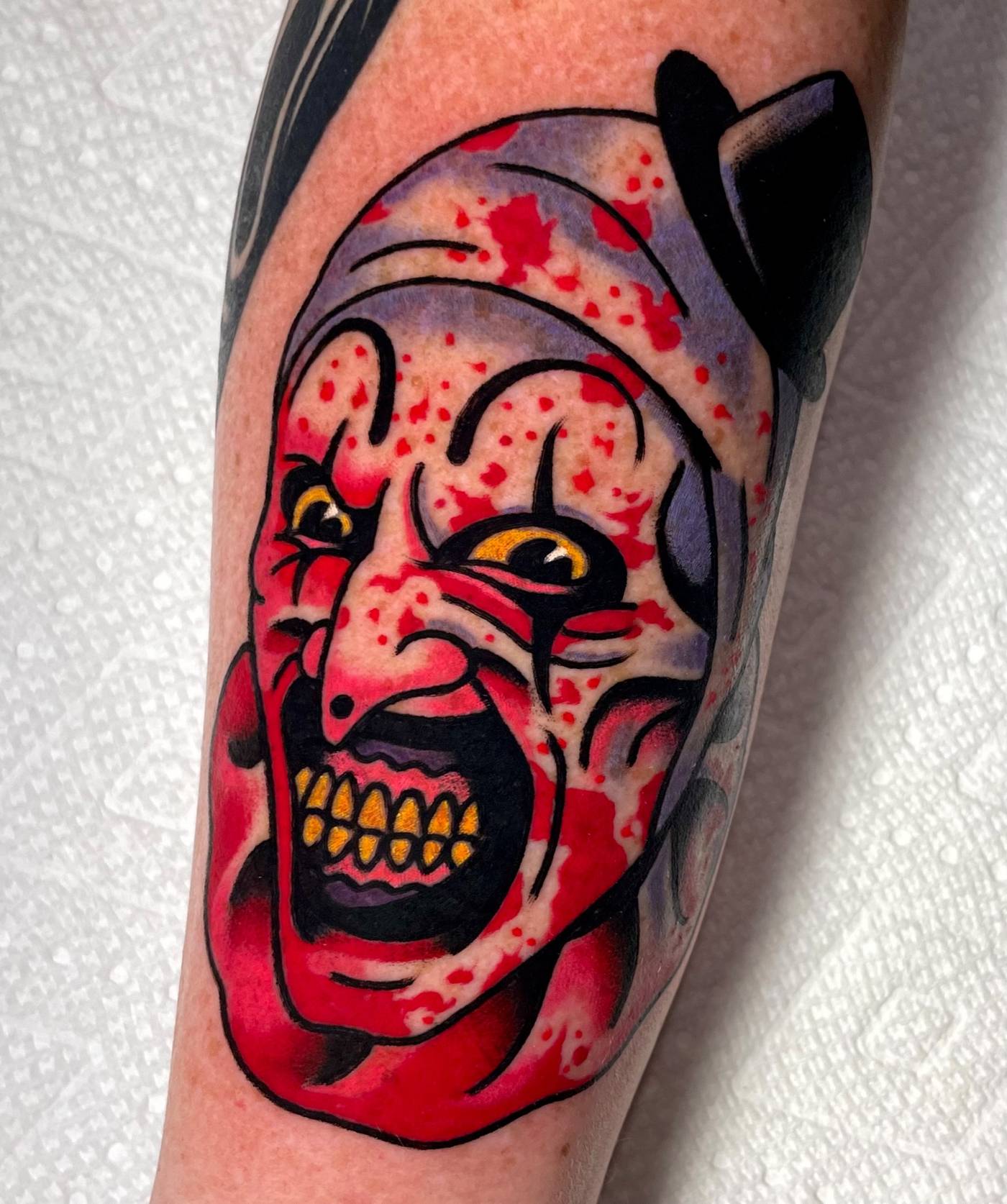 Work by Ryan McDonald on calf