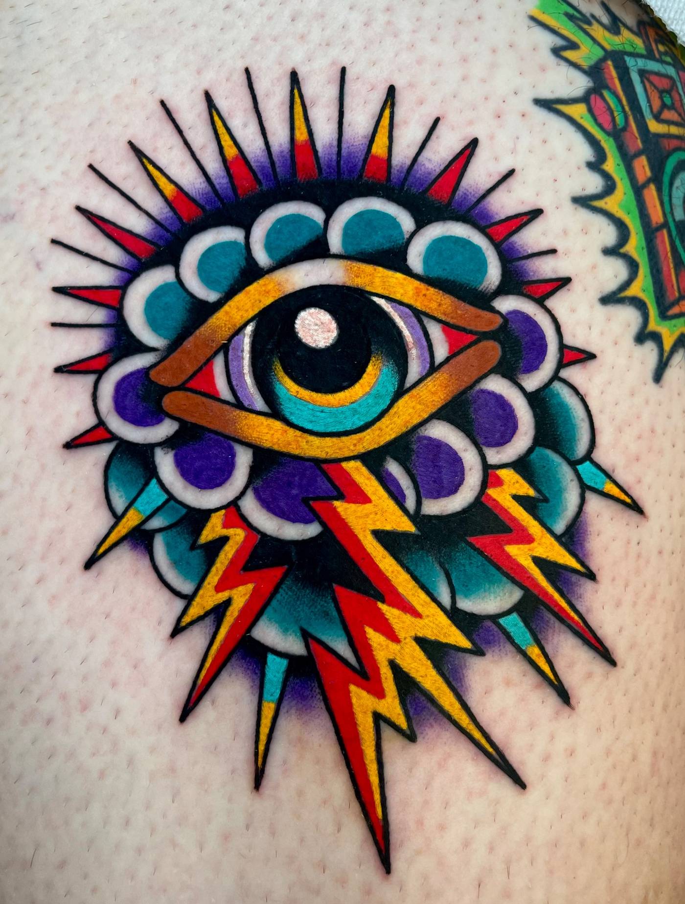 Work by Ryan McDonald on thigh