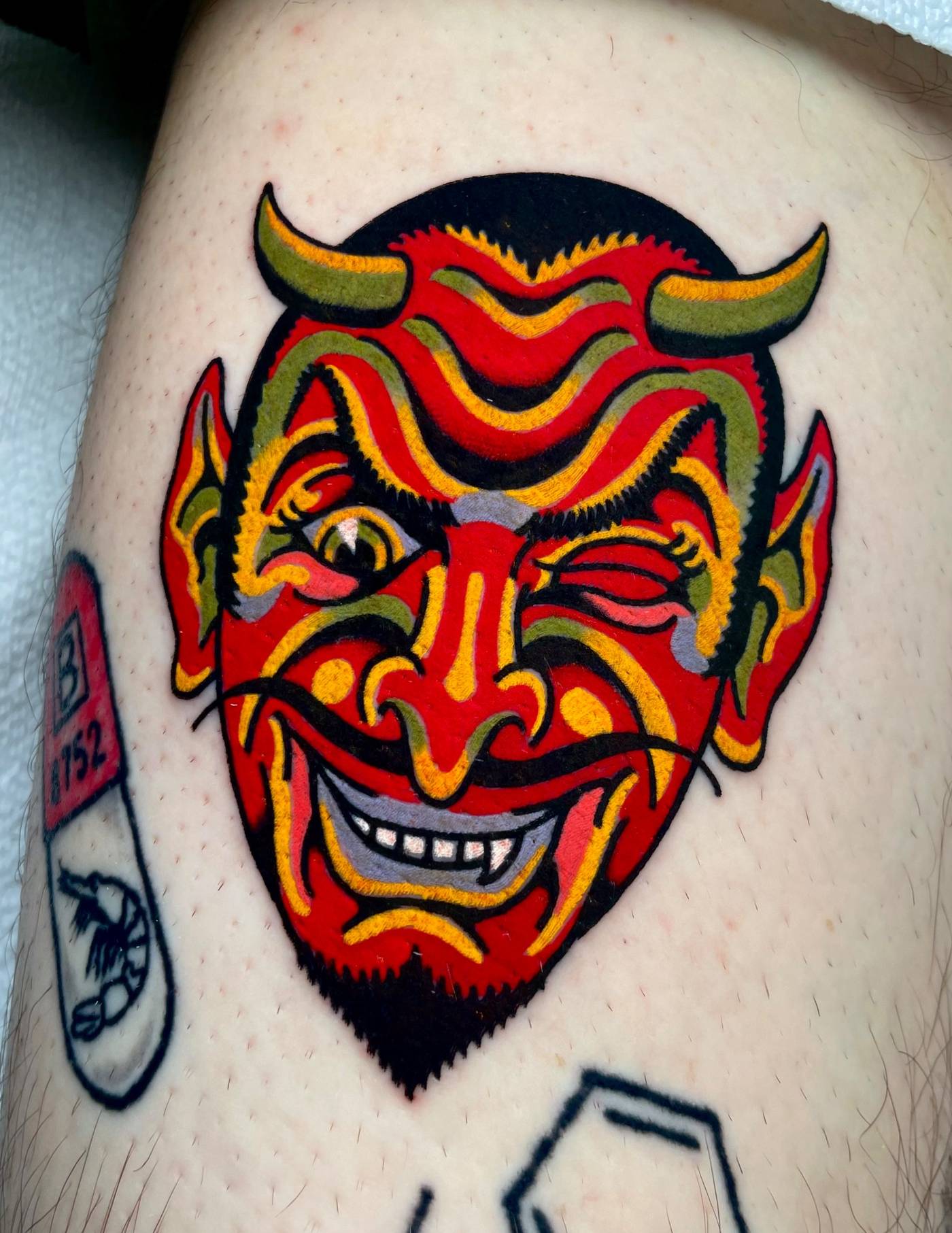 Work by Ryan McDonald on thigh