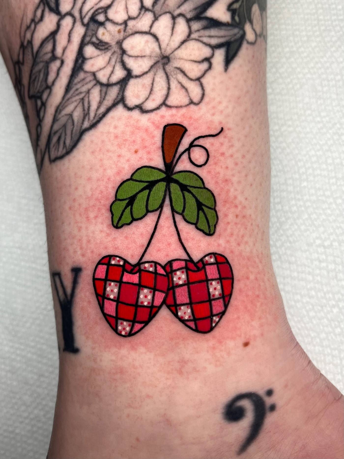 Work by Alena McDonald on ankle